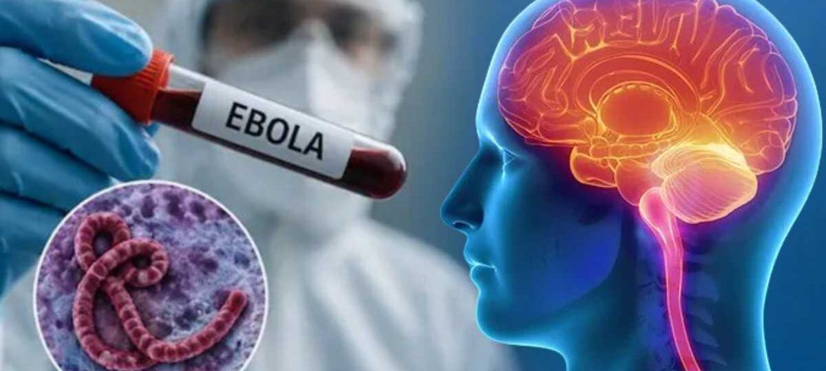 ඉබෝලා වෛරසය සහ මෙනින්ජයිටීස් රෝගය සඳහා ලංකාව සූදානම්.?